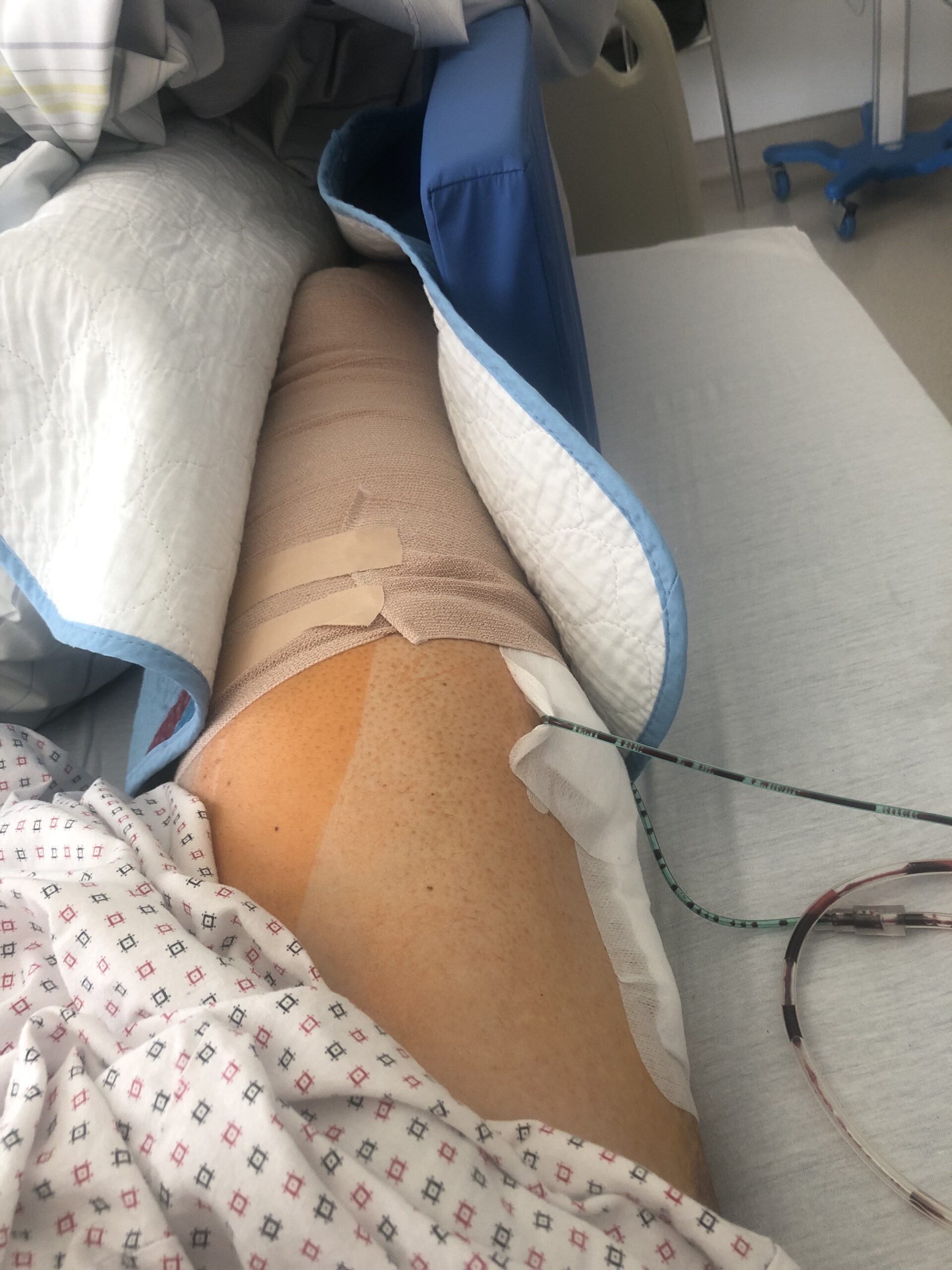 Post OP